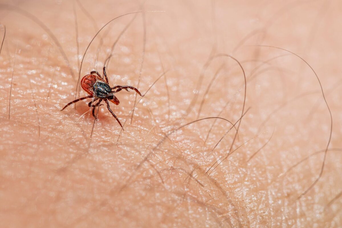 symptômes allergie acariens faut il tests